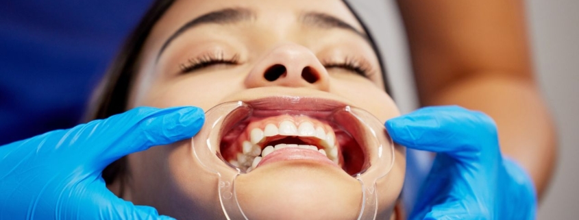 Kjeveplager og tanngnissing