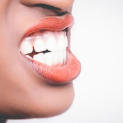 Hva gjør man når en tann knekker? Glomma Tannklinikk